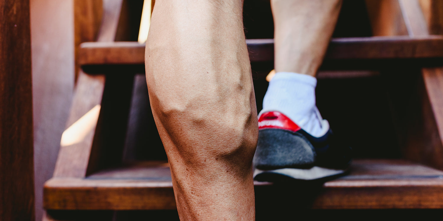Proširene vene i fitnes