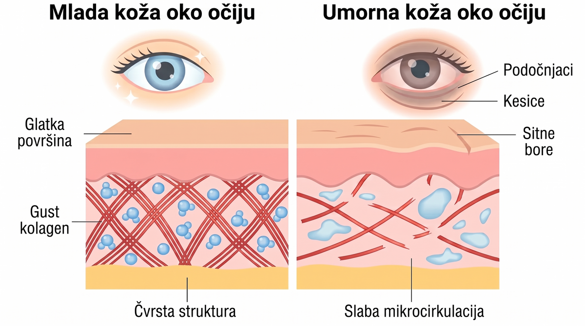 Rose Eye Lift RS eyev1