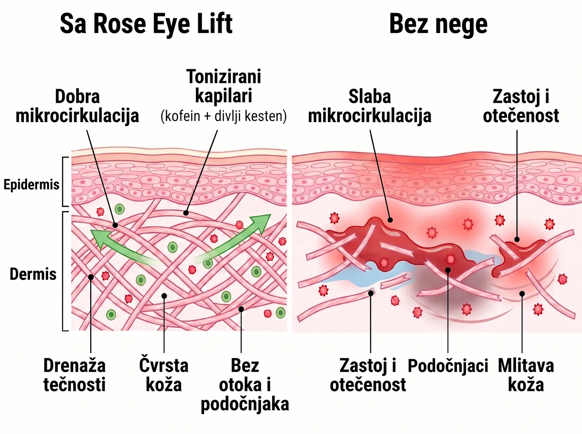 Rose Eye Lift RS t17